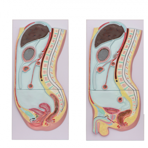 腹膜矢狀切面模型